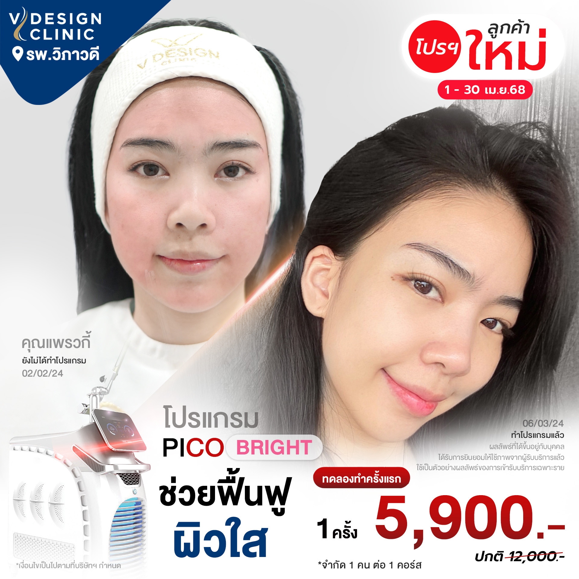 promotion img
