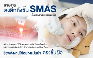 เจาะลึก Ulthera เทคโนโลยียกกระชับผิวสุดฮิต ที่คุณต้องรู้